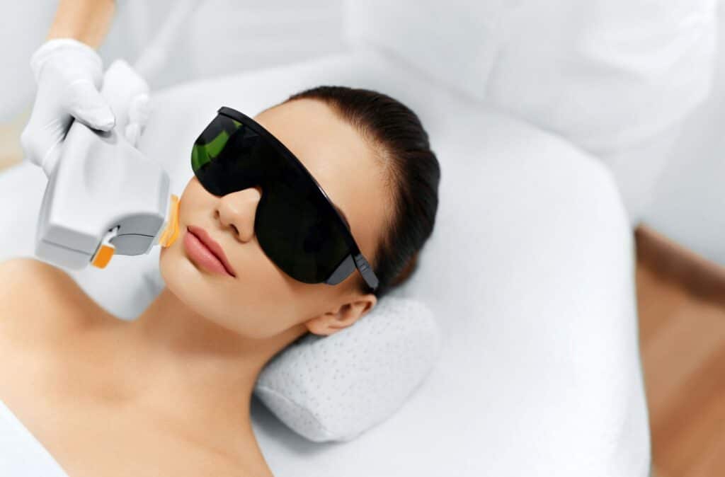 IPL Photofacials