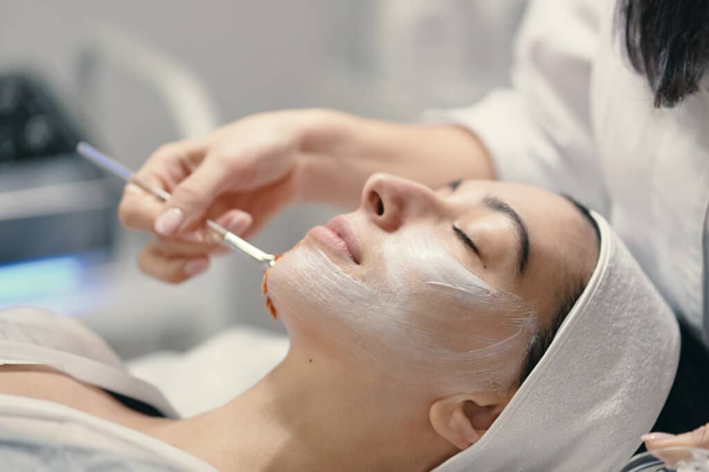 chemical peel